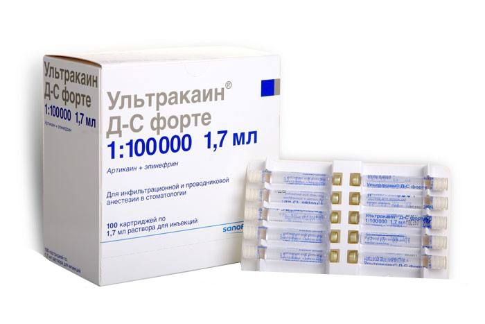 Ультракаин Д-С форте, 40 мг+10 мкг/мл, раствор для инъекций, с эпинефрином, 1.7 мл, 100 шт.